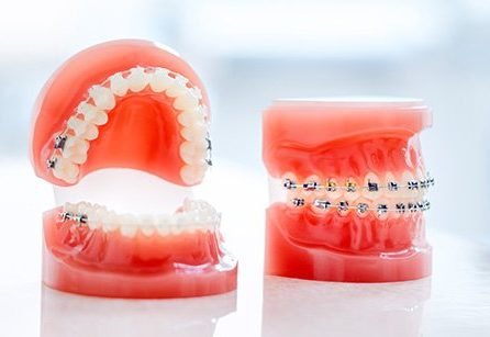 Living Your Best Life with Braces: Tips for Making the Most of Your Treatment Journey