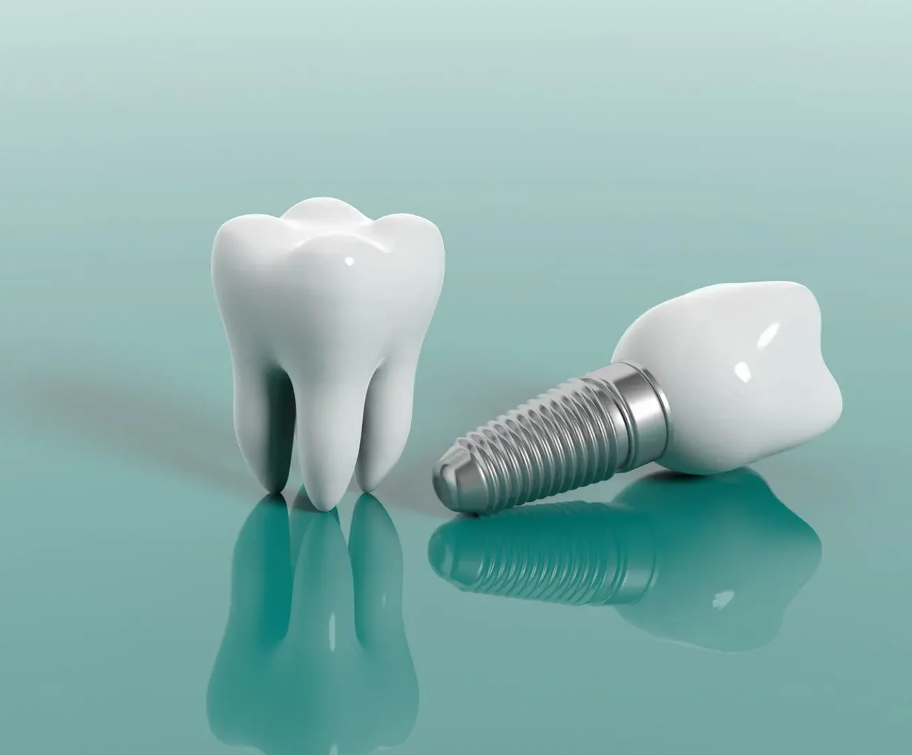From Start to Smile: A Simple Guide to the Dental Implant Process