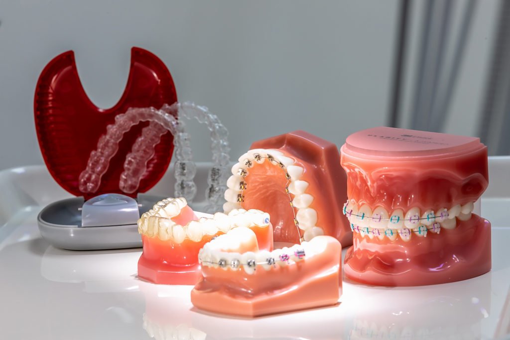 Troubleshooting Orthodontic Concerns: Recognizing and Fixing Issues