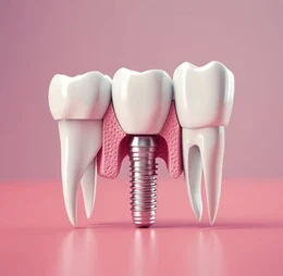 Dental Implants: How They Boost Your Oral Health and Happiness