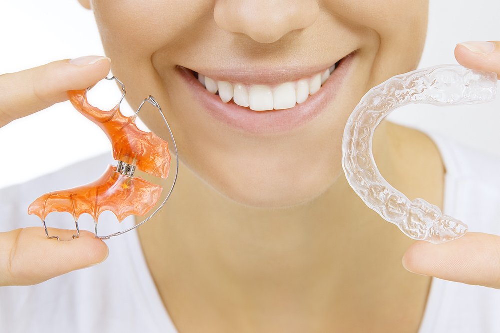 Retain Your Smile: The Importance of Retainers After Orthodontic Treatment