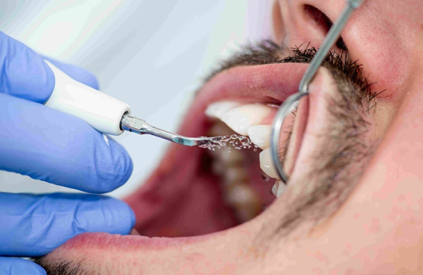 Save Your Smile With Scaling.