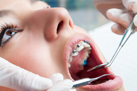 Why orthodontic treatment is a lifelong investment?