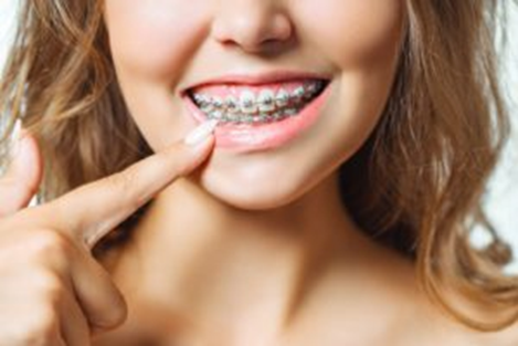 The Psychology of a Smile: How Orthodontics Impacts Self-Esteem