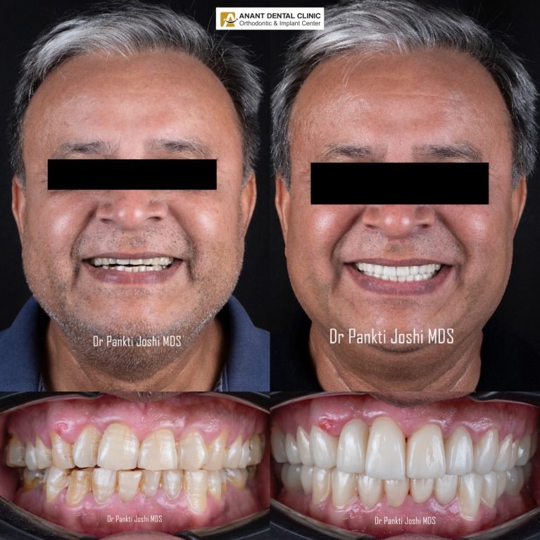 collage_export_199BE976-AE2A-44BD-AF60-41C28EF88BF8