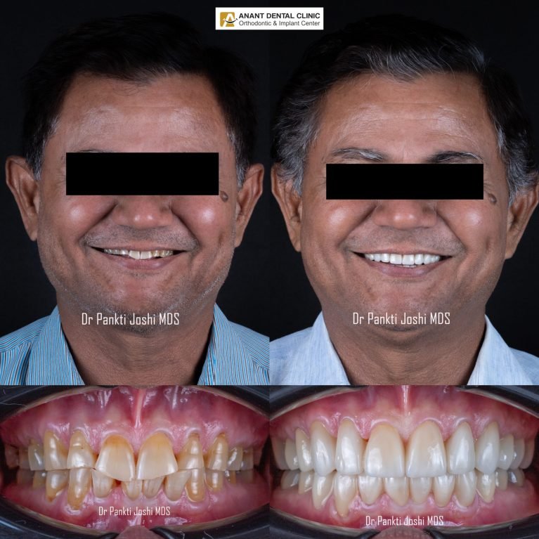 collage_export_2283F71D-8781-4848-808B-88B40DBB870B