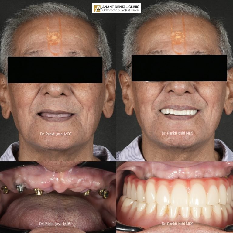 collage_export_50E919CD-FD33-4F22-85D0-912569E50119