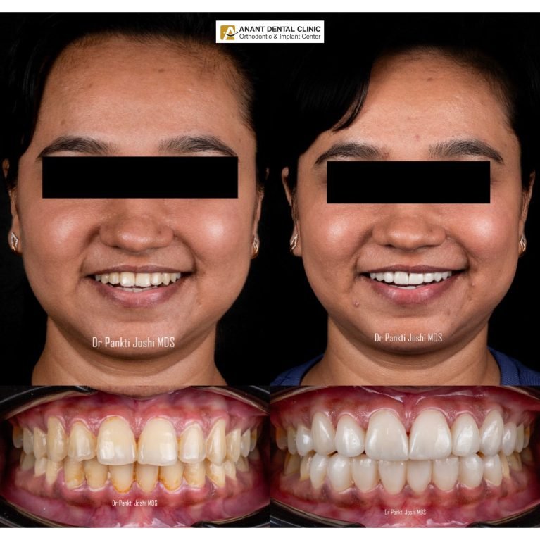collage_export_D16F976E-DA15-4BDD-8F2D-68813369FE4D